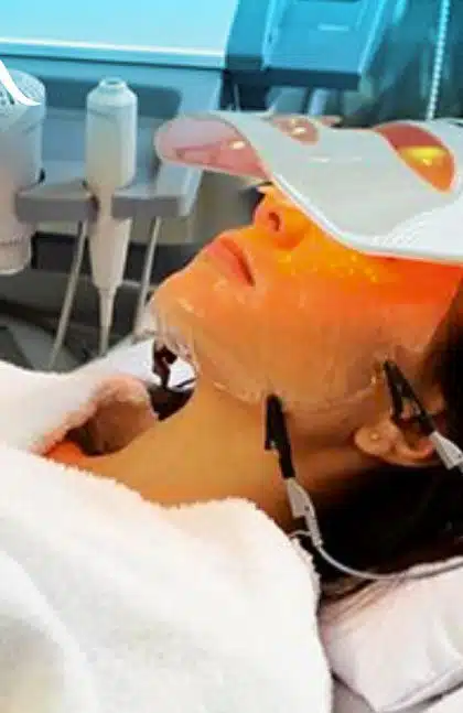 Limpieza Facial profunda con Skinlight